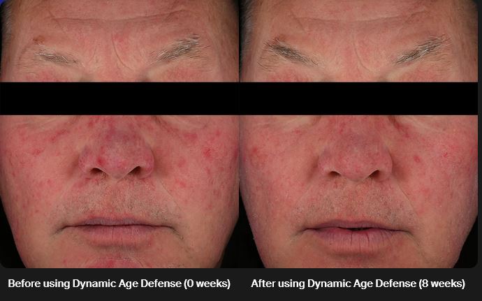 Before and After Results